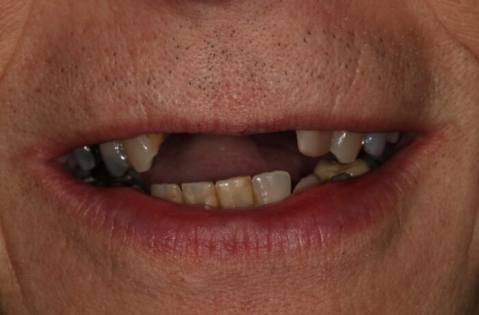 Before - Cheadle Hulme Dental