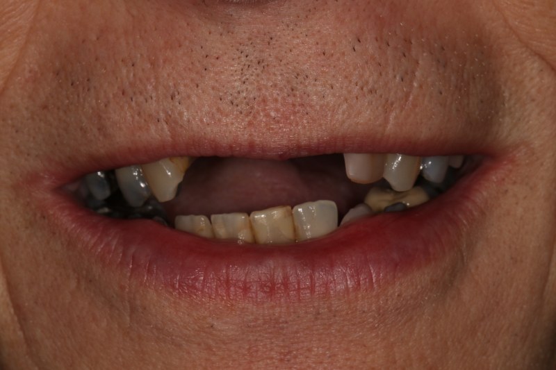 Before - Cheadle Hulme Dental