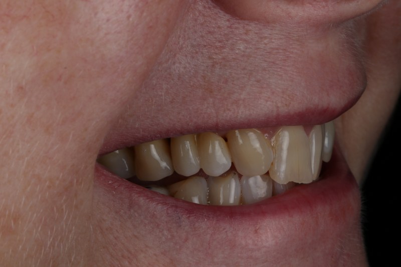 After - Cheadle Hulme Dental