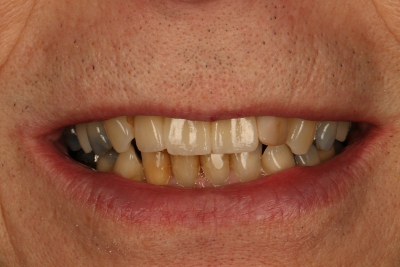 After - Cheadle Hulme Dental