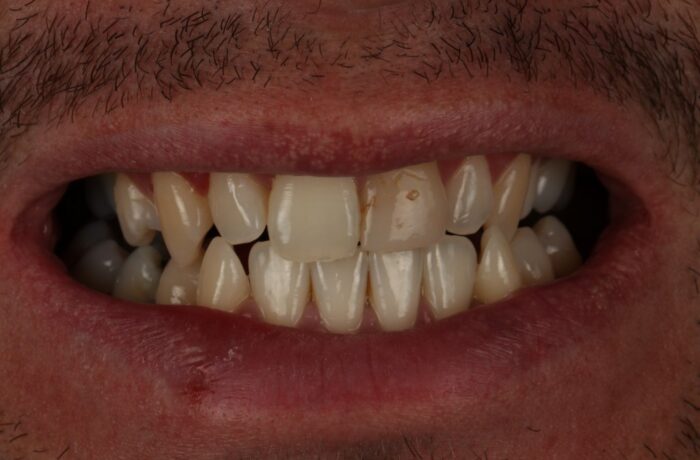 Before - Cheadle Hulme Dental