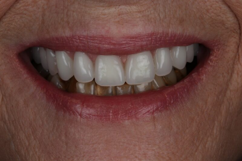 After - Cheadle Hulme Dental