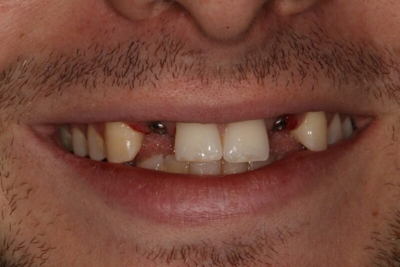 Before - Cheadle Hulme Dental