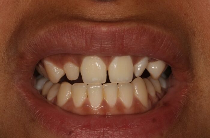 Before - Cheadle Hulme Dental