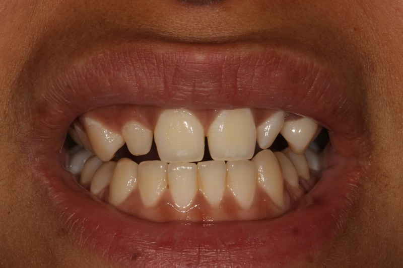 Before - Cheadle Hulme Dental