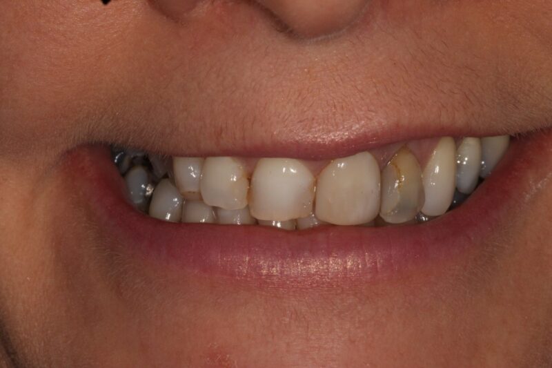 Before - Cheadle Hulme Dental