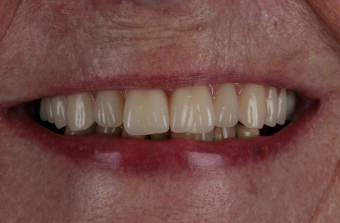 After - Cheadle Hulme Dental