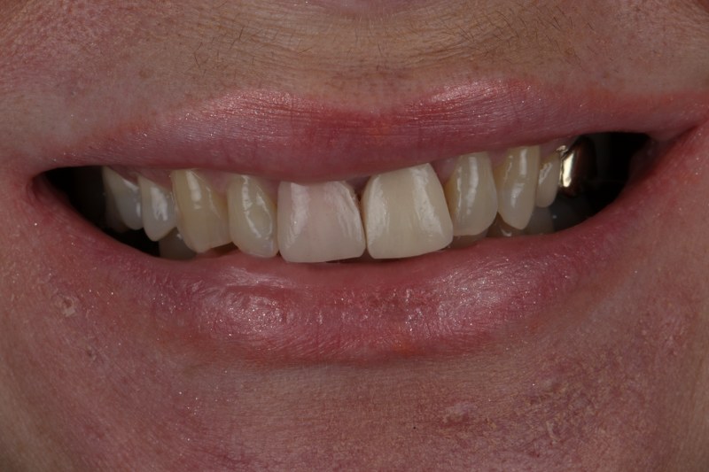 Before - Cheadle Hulme Dental