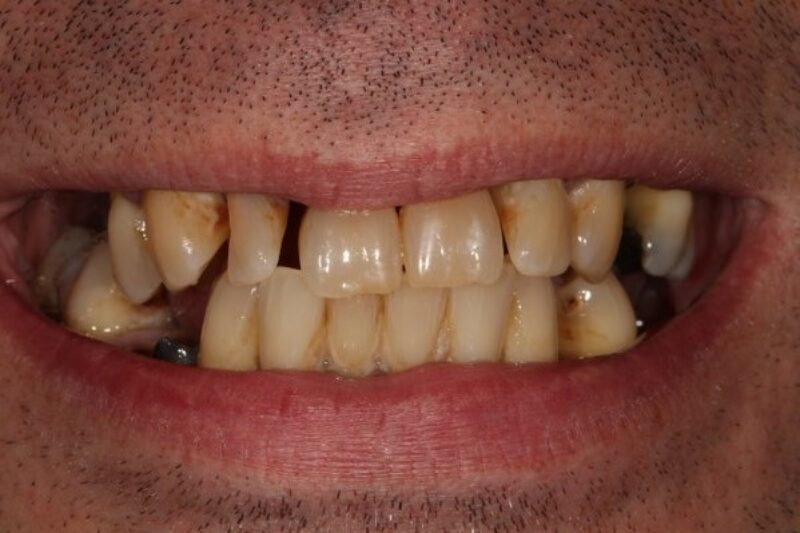 Before - Cheadle Hulme Dental