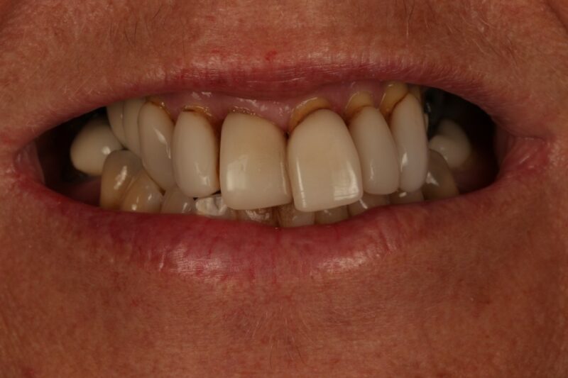 Before - Cheadle Hulme Dental