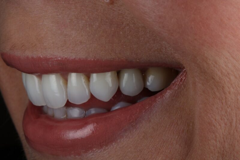 After - Cheadle Hulme Dental