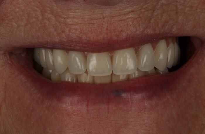 After - Cheadle Hulme Dental