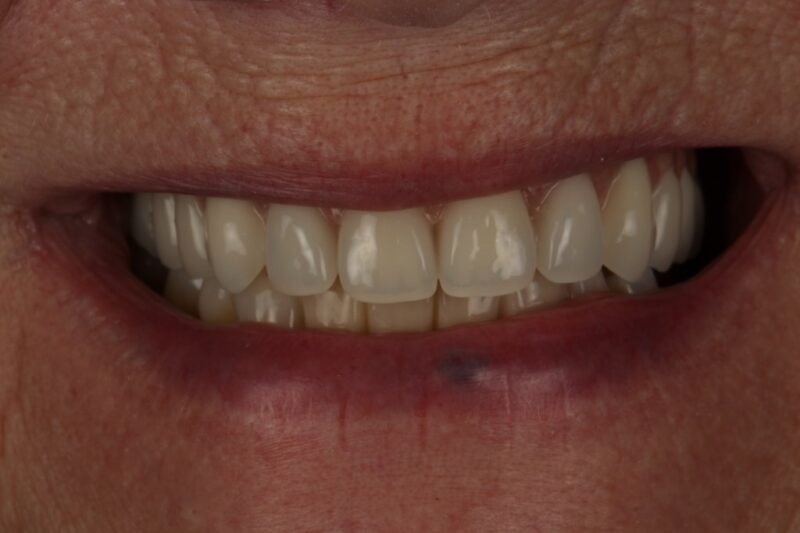 After - Cheadle Hulme Dental