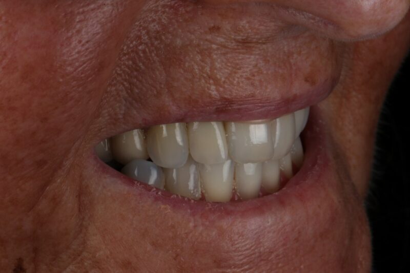 After - Cheadle Hulme Dental