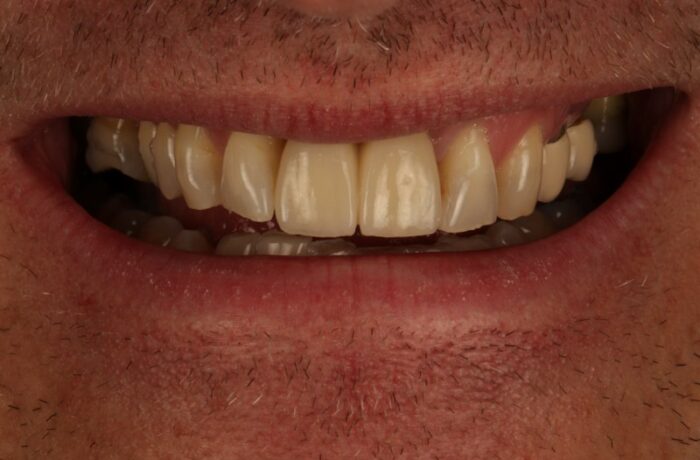 After - Cheadle Hulme Dental