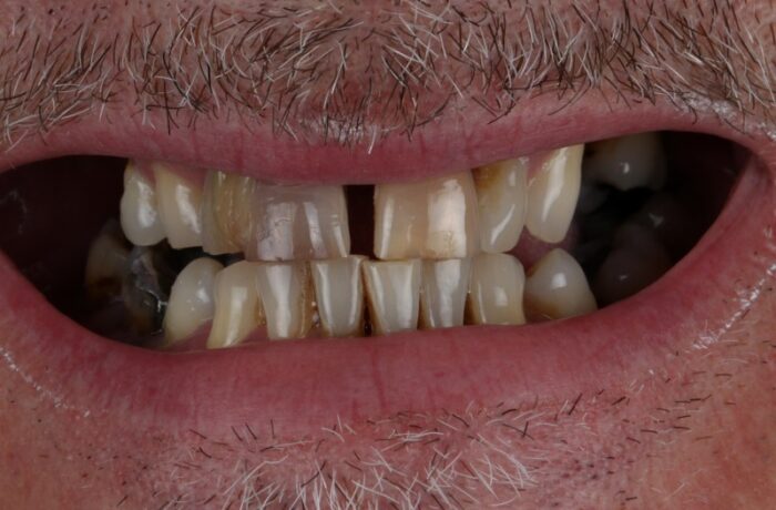 Before - Cheadle Hulme Dental