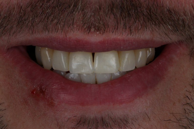 After - Cheadle Hulme Dental