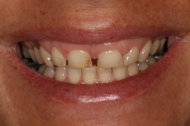 Before - Cheadle Hulme Dental