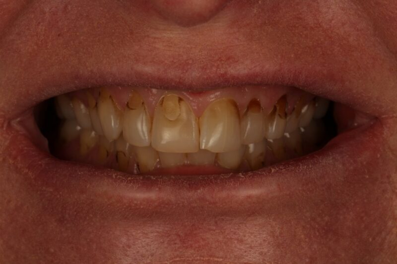 Before - Cheadle Hulme Dental