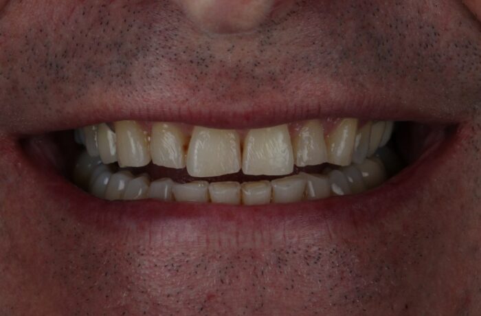 Before - Cheadle Hulme Dental