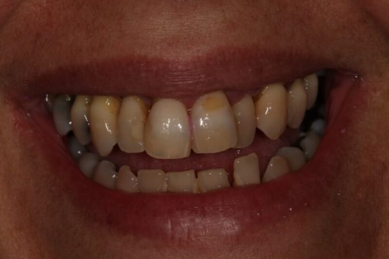 Before - Cheadle Hulme Dental