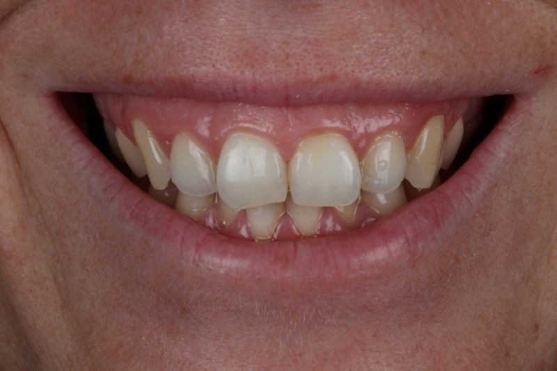 Before - Cheadle Hulme Dental