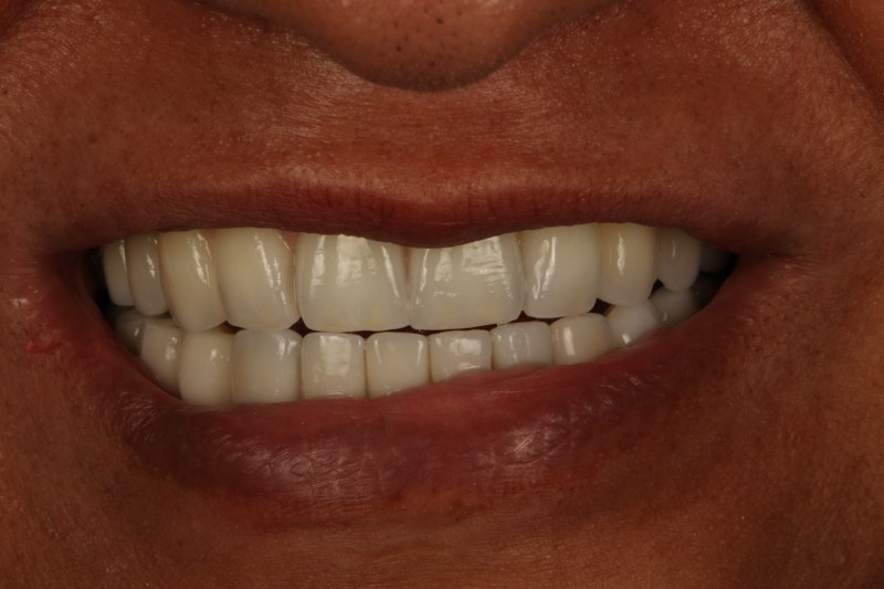 After - Cheadle Hulme Dental