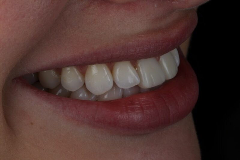 After - Cheadle Hulme Dental