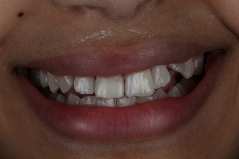 After - Cheadle Hulme Dental