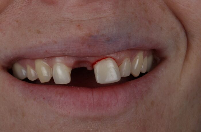 Before - Cheadle Hulme Dental