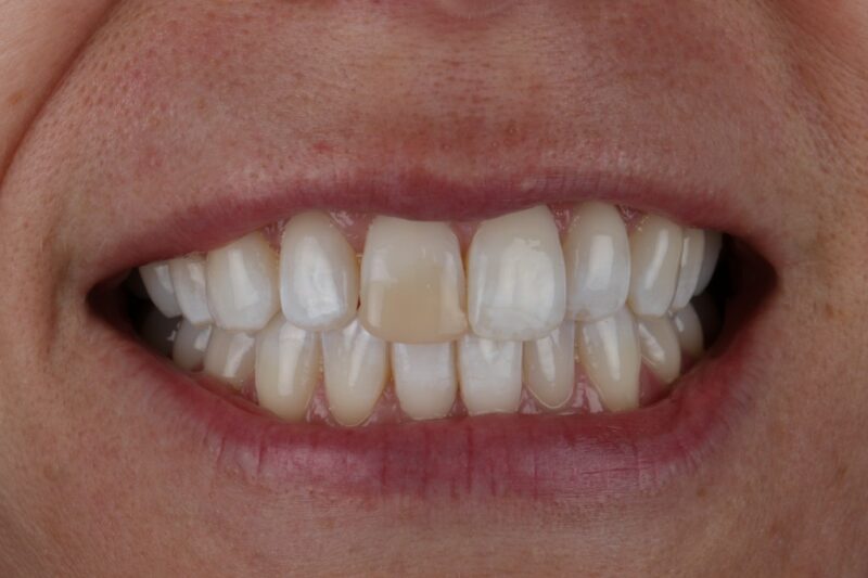 Before - Cheadle Hulme Dental