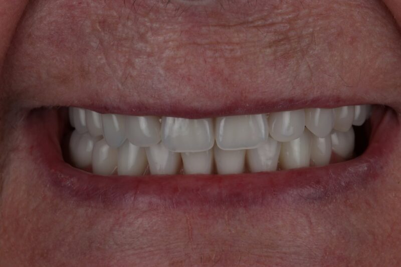 After - Cheadle Hulme Dental