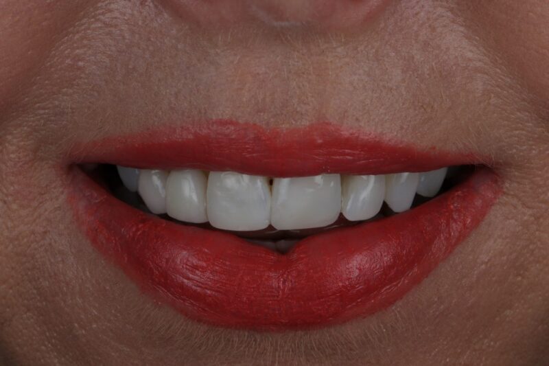 After - Cheadle Hulme Dental