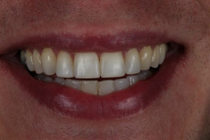 After - Cheadle Hulme Dental