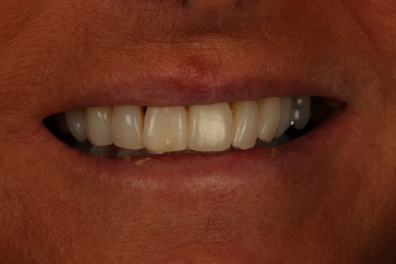 After - Cheadle Hulme Dental