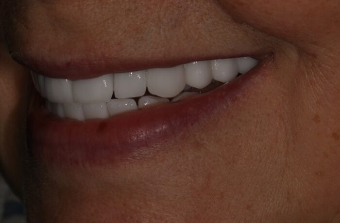 After - Cheadle Hulme Dental