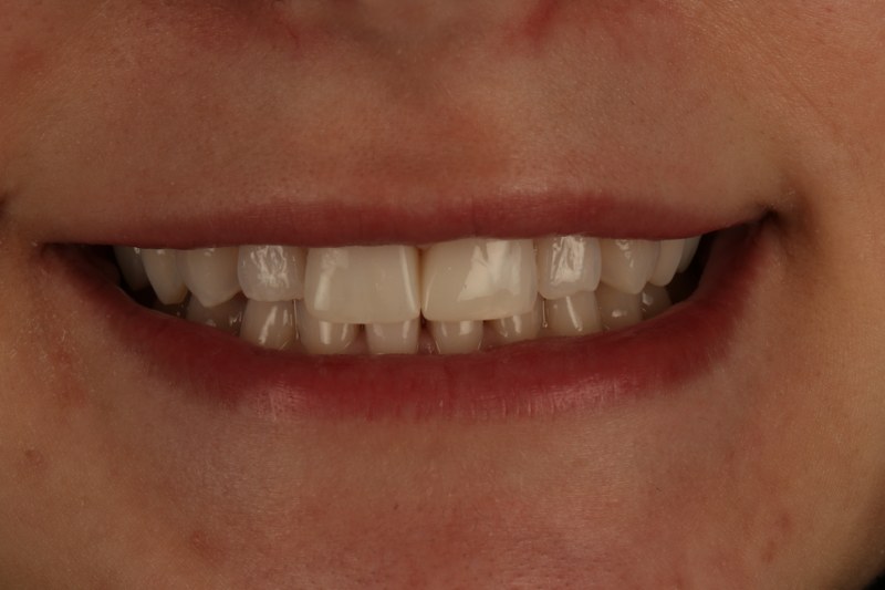 After - Cheadle Hulme Dental