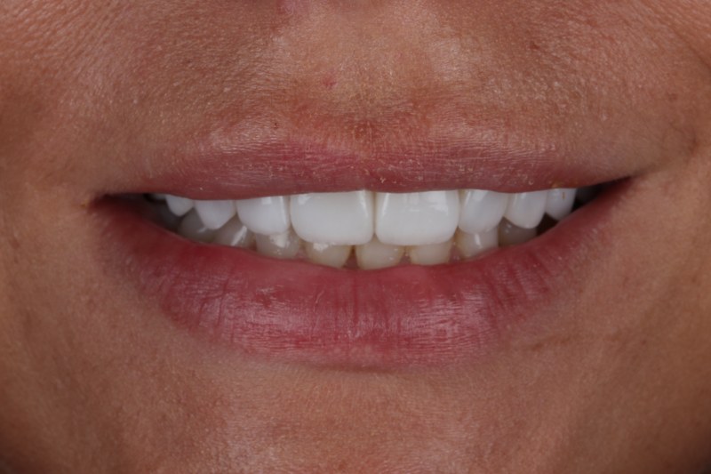 After - Cheadle Hulme Dental