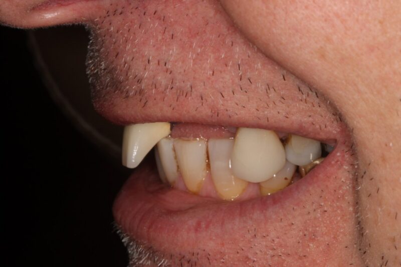 Before - Cheadle Hulme Dental