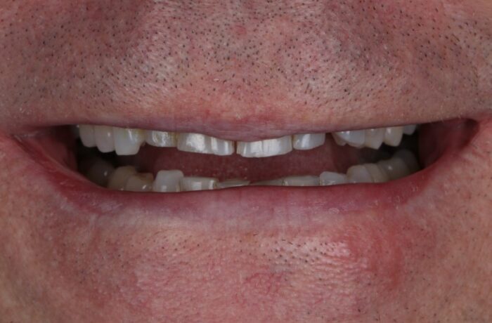 Before - Cheadle Hulme Dental