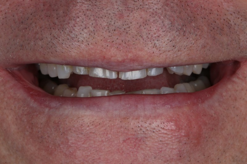 Before - Cheadle Hulme Dental