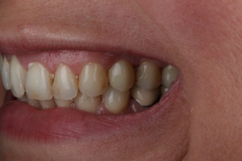 After - Cheadle Hulme Dental