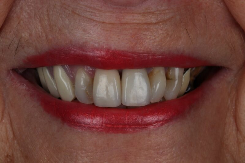 After - Cheadle Hulme Dental