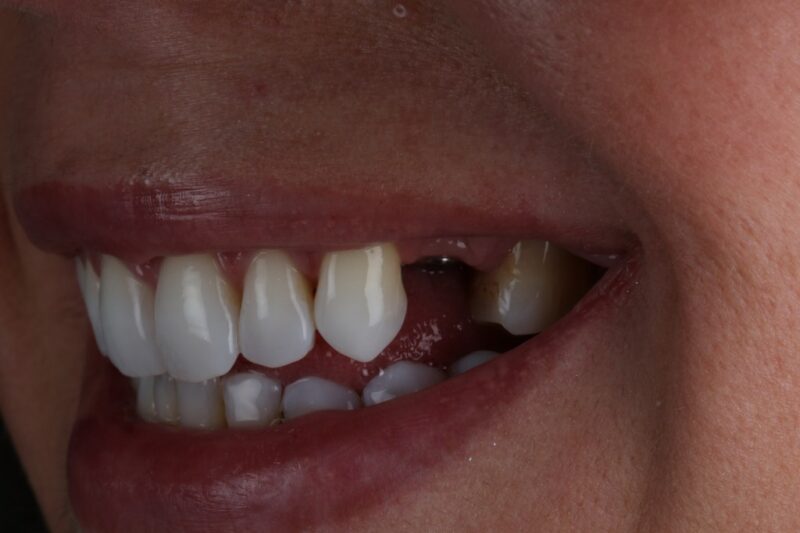 Before - Cheadle Hulme Dental