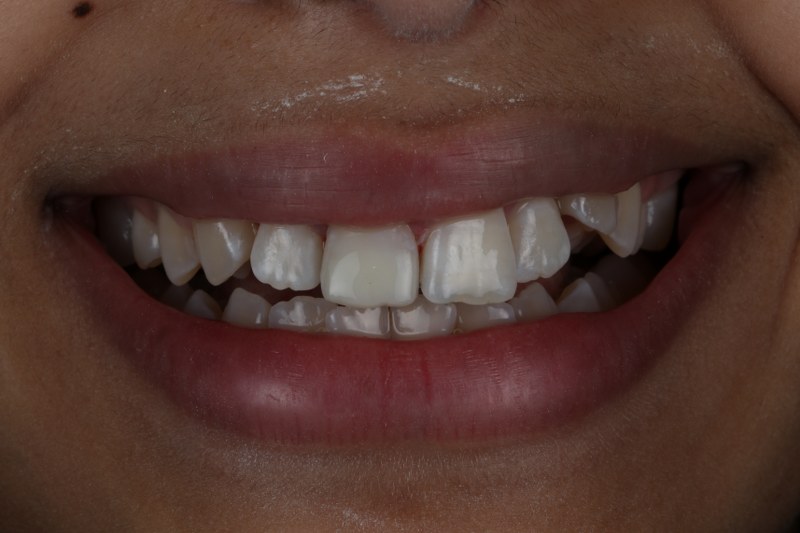 After - Cheadle Hulme Dental