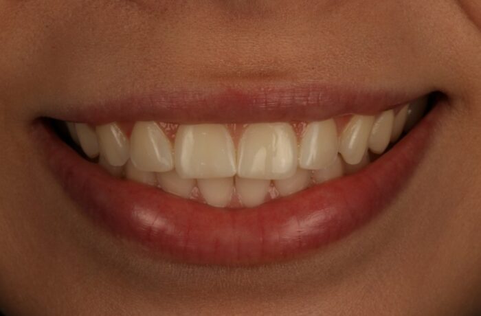 After - Cheadle Hulme Dental