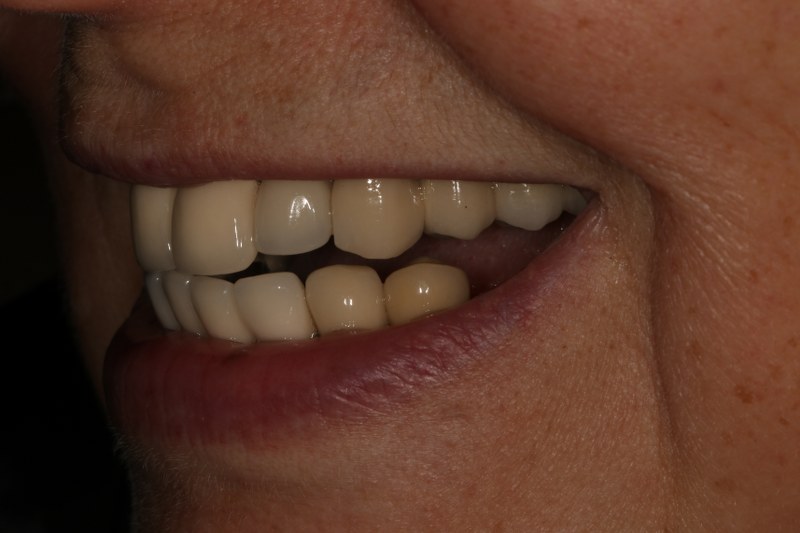 Before - Cheadle Hulme Dental