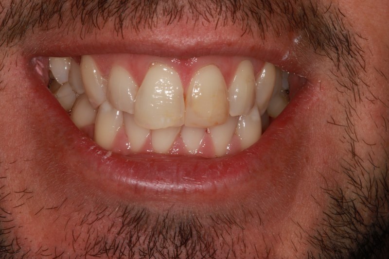 Before - Cheadle Hulme Dental