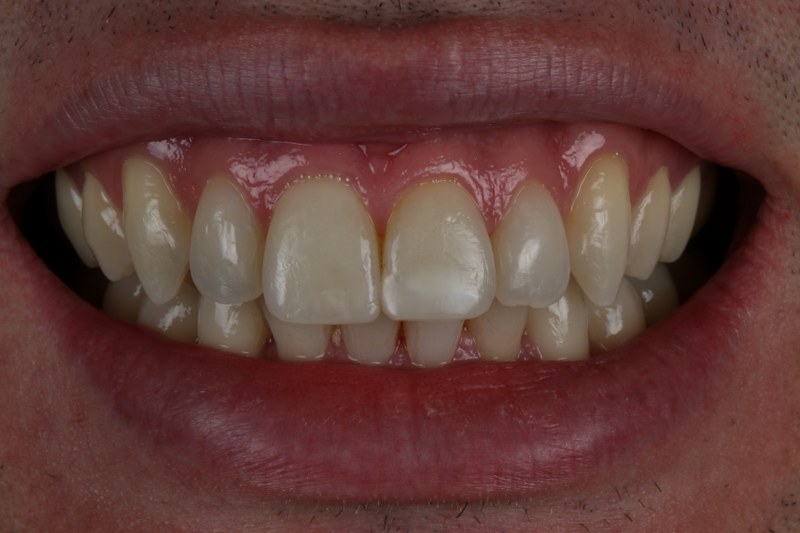 After - Cheadle Hulme Dental