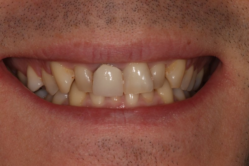 Before - Cheadle Hulme Dental